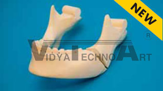 Mandible, fractured replacement part, Clip